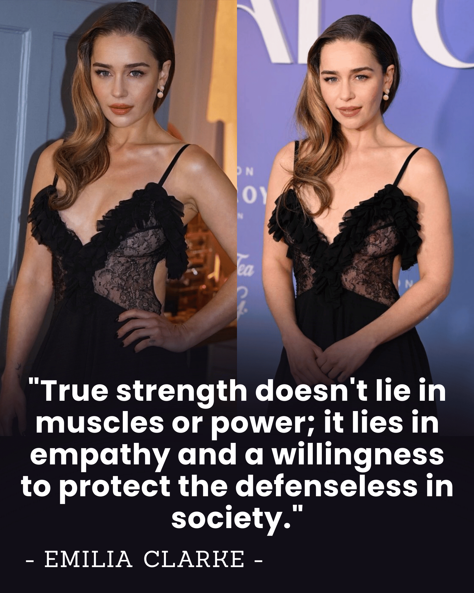 “I Showed My Scars to the World” — Emilia Clarke’s SHOCK Confession After 2 Brain Aneurysms Is Redefining Strength in Hollywood.