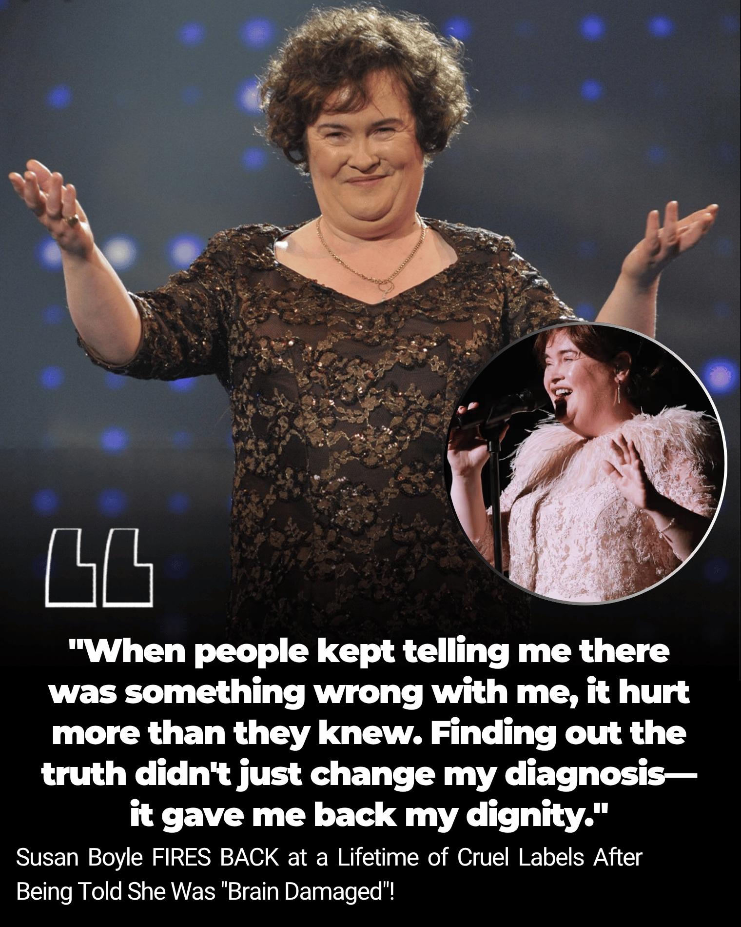 Susan Boyle FIRES BACK at a Lifetime of Cruel Labels After Being Told She Was “Brain Damaged”!